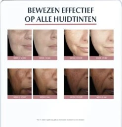 Eucerin Anti-Pigment Spotcorrector - Concealer - 5 Ml -Cosmetisch Kortingswinkel 1157x1200 4