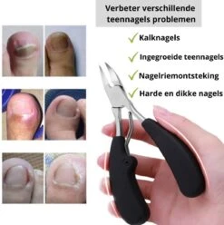 Merkloos Nageltang Voor Harde Teennagels - Manicureset Teennagelknipper - Teennagelschaar - Pedicure Set -Cosmetisch Kortingswinkel 1196x1200 10