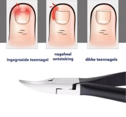 Medies - Professionele Zware Nageltang Voor Teennagels | Nagelknipper Teennagels | Ingegroeide Teennagel | Kalknagel | Harde Teennagels | Nagelschaar | Pedicure - Ingebouwde Veren -Cosmetisch Kortingswinkel 1200x1113 3