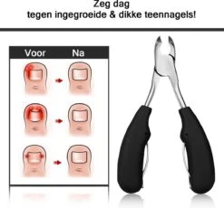 Merkloos Nageltang Met Gebogen Bek + Vijl - Nagelknipper Set - Pedicure Set -Cosmetisch Kortingswinkel 1200x1117 7