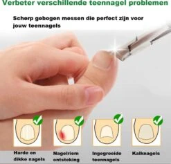 Merkloos Nageltang Met Gebogen Bek + Vijl - Nagelknipper Set - Pedicure Set -Cosmetisch Kortingswinkel 1200x1153 1