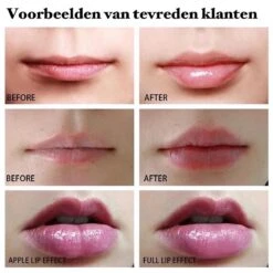 BenjaBeauty Lip Plumper - Lippen - Lipstick - Lippenbalsem - Rood - Wit -Cosmetisch Kortingswinkel 1200x1200 1604