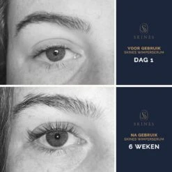 Skines® Wimperserum Premium – Eyelash Serum - Wenkbrauw Serum - Wimper Groei - 3ML -Cosmetisch Kortingswinkel 1200x1200 1745