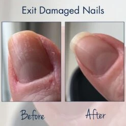 Herome Combi-Pack Exit Damaged Nails & Nagelverharder Extra Sterk (Nail Hardener Extra Strong) - Herstelt Beschadigde Nagels En Zorgt Voor Ijzersterke Nagels - 7ml. & 10ml. 15 Herome Combi-Pack Exit Damaged Nails & Nagelverharder Extra Sterk (Nail Hardener Extra Strong) - Herstelt Beschadigde Nagels En Zorgt Voor Ijzersterke Nagels - 7ml. & 10ml. -Cosmetisch Kortingswinkel 1200x1200 18