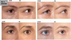 L'Oréal Paris Clinically Proven Wimperserum - 2 Ml -Cosmetisch Kortingswinkel 1200x670 5