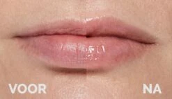 Instant Effects - 3D Lip Plumper Lipgloss Lip Filler - 20% Vollere Lippen In Slechts 2 Minuten! -Cosmetisch Kortingswinkel 1200x696 3