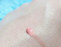 Biodermal Sun Lipbalm SPF25 - Tube 12 Ml - Natural Pink - Lippenbalsem 7 Biodermal Sun Lipbalm SPF25 - Tube 12 Ml - Natural Pink - Lippenbalsem -Cosmetisch Kortingswinkel 1200x927 4