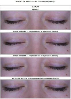 Oceanic Long4Lashes Gold Eyelash Wimpernserum 4 Ml -Cosmetisch Kortingswinkel 859x1200 2